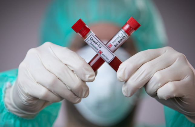 В Україні коронавірус вбив 37 осіб за добу: статистика на 28 вересня