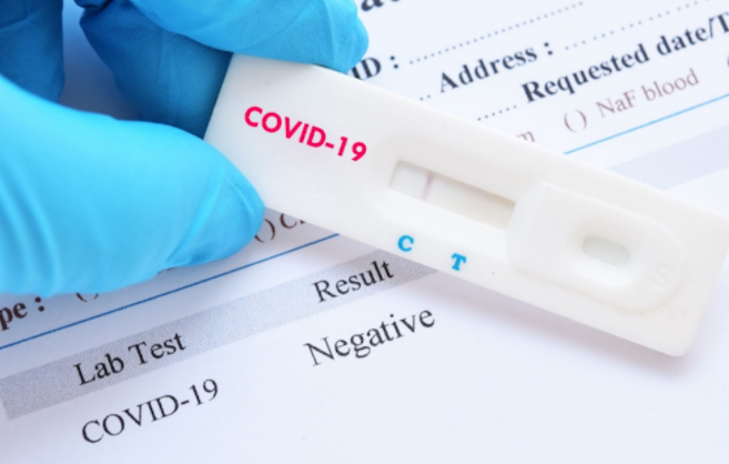 Тест на коронавірус: за яких умов його зроблять безкоштовно