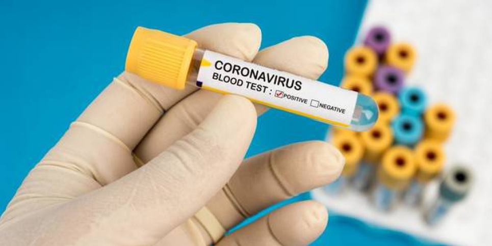 Антитіла до коронавірусу атакують не вірус, а людину — дослідження